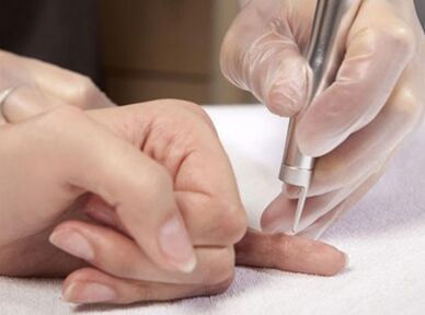 Carrying out laser therapy