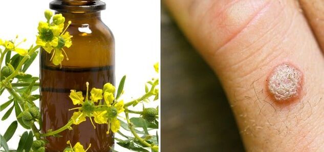 Treatment of warts with pharmaceutical celandine